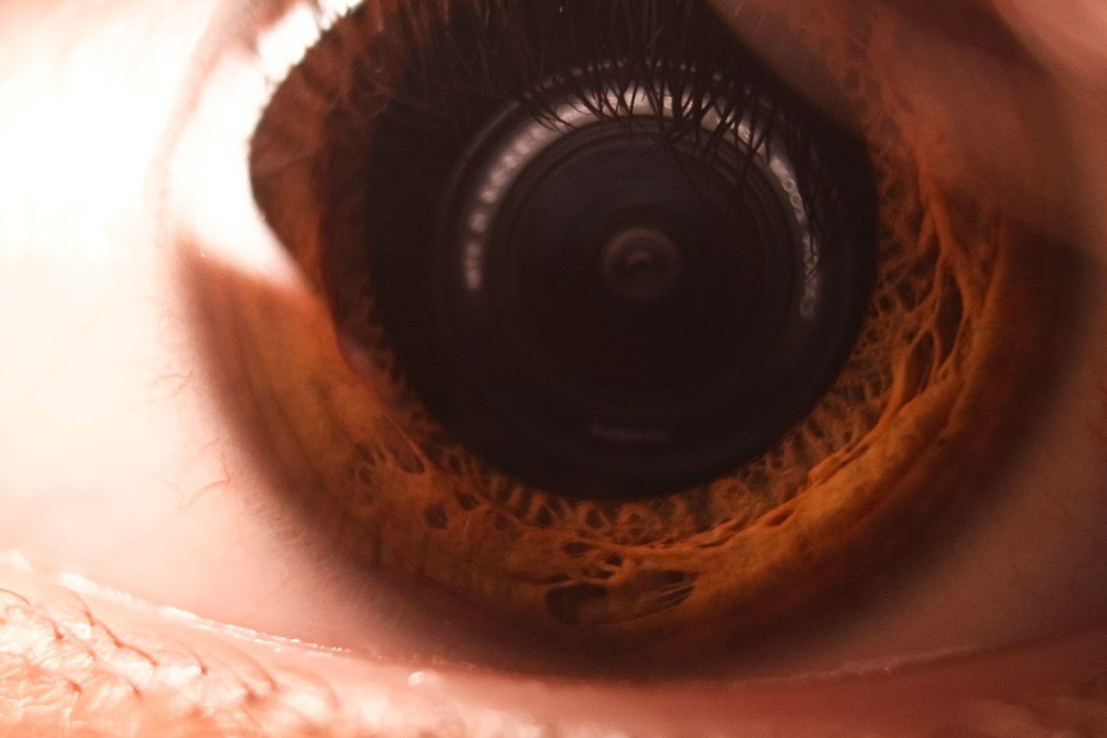 Waar je op moet letten als je een lensimplantatie overweegt als nieuwe mama